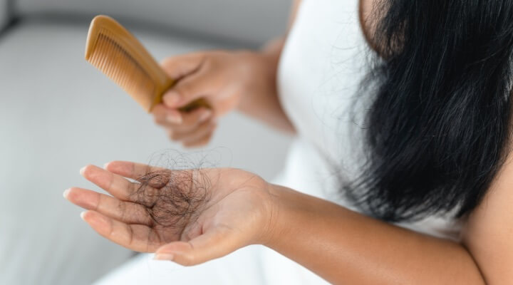 woman with hair loss